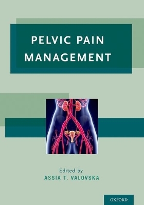 Pelvic Pain Management - 