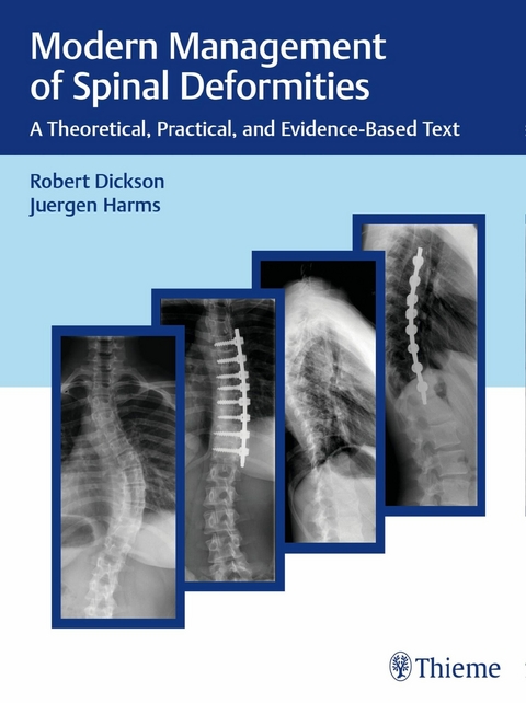 Modern Management of Spinal Deformities -  Robert A. Dickson,  Jürgen Harms