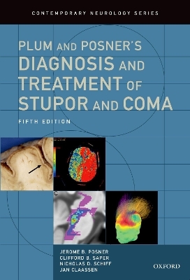 Plum and Posner's Diagnosis and Treatment of Stupor and Coma - Jerome B. Posner, Clifford B. Saper, Nicholas D. Schiff, Jan Claassen