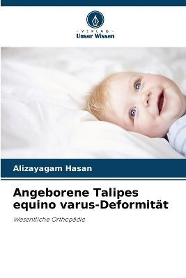 Angeborene Talipes equino varus-Deformität - Alizayagam Hasan