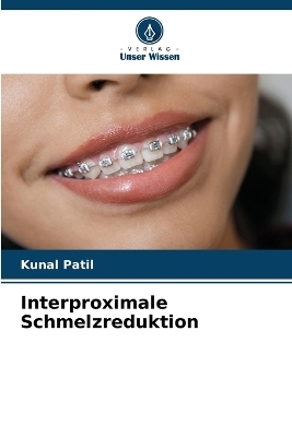 Interproximale Schmelzreduktion - Kunal Patil, Rashmi Kunal Patil, Nitin D Gulve