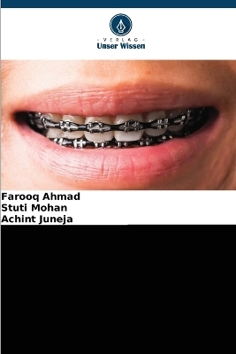 Biologie und Biomarker der beschleunigten kieferorthopädischen Zahnbewegung - Farooq Ahmad, Stuti Mohan, ACHINT JUNEJA