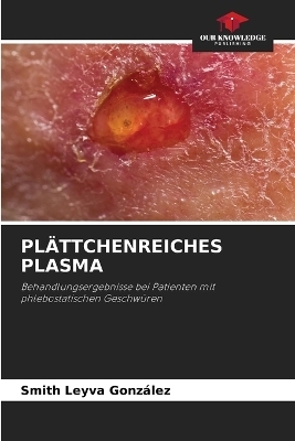 Plättchenreiches Plasma - Smith Leyva González