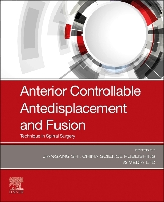 Anterior Controllable Antedisplacement and Fusion - 