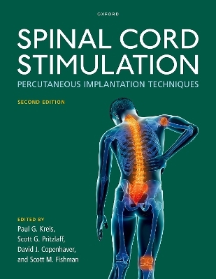 Spinal Cord Stimulation - 