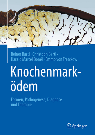 Knochenmarködem - Reiner Bartl; Christoph Bartl; Harald Marcel Bonél …