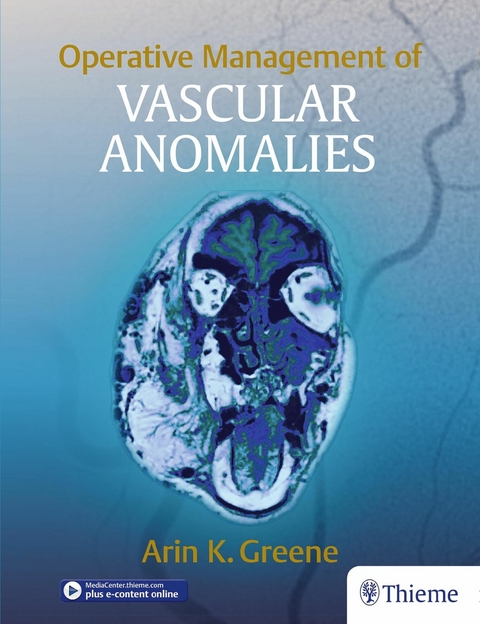 Operative Management of Vascular Anomalies - 