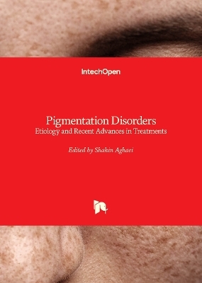 Pigmentation Disorders - 