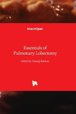 Essentials of Pulmonary Lobectomy - 
