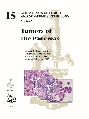 Tumors of the Pancreas - David S. Klimstra, Ralph H. Hruban, Carlie S. Sigel, Günter Klöppel