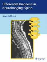 Differential Diagnosis in Neuroimaging: Spine - 