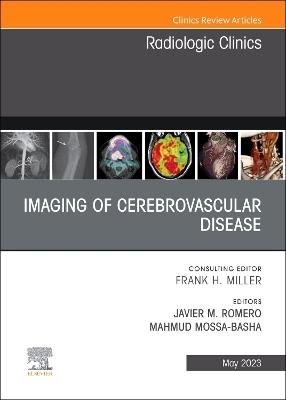 Imaging of Cerebrovascular Disease, An Issue of Radiologic Clinics of North America - 