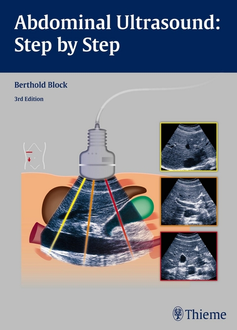 Abdominal Ultrasound: Step by Step -  Berthold Block