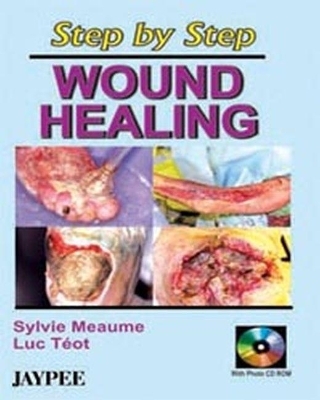 Step by Step Wound Healing - Sylvie Meaume, Luc Teot