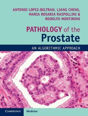 Pathology of the Prostate - Antonio Lopez-Beltran, Liang Cheng, Rodolfo Montironi, Maria Rosaria Raspollini