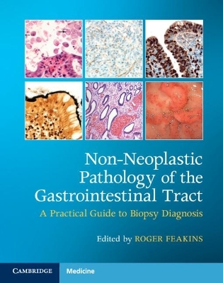 Non-Neoplastic Pathology of the Gastrointestinal Tract with Online Resource - 