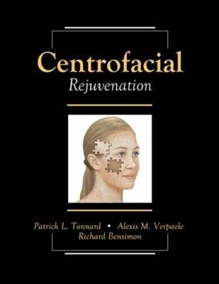 Centrofacial Rejuvenation - Patrick Tonnard, Alexis Verpaele, Richard Bensimon