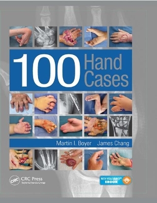 100 Hand Cases - Martin Boyer, James Chang