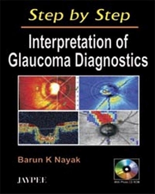 Step by Step Interpreattion of Glaucoma - K. Nayak