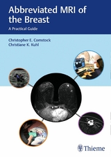 Abbreviated MRI of the Breast - Christopher E. Comstock, Christiane Kuhl