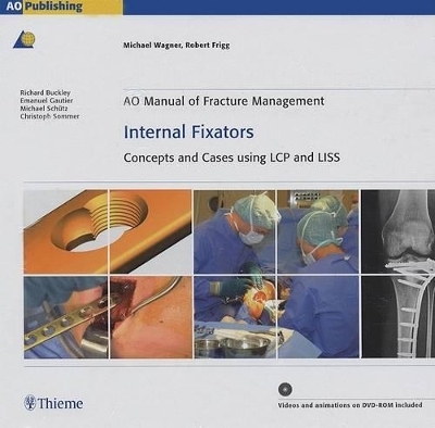 AO Manual of Fracture Management: Internal Fixators - Michael Wagner, Robert Frigg