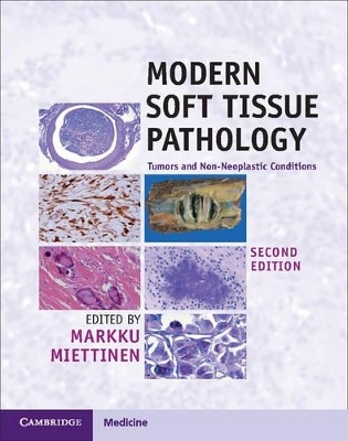 Modern Soft Tissue Pathology - 