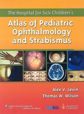 The Hospital for Sick Children's Atlas of Pediatric Ophthalmology and Strabismus - 