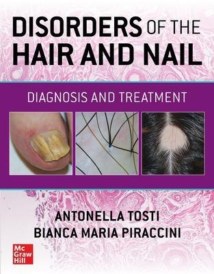 Disorders of the Hair and Nail: Diagnosis and Treatment - Antonella Tosti, Bianca Maria Piraccini