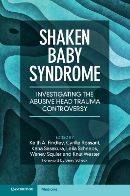 Shaken Baby Syndrome - 