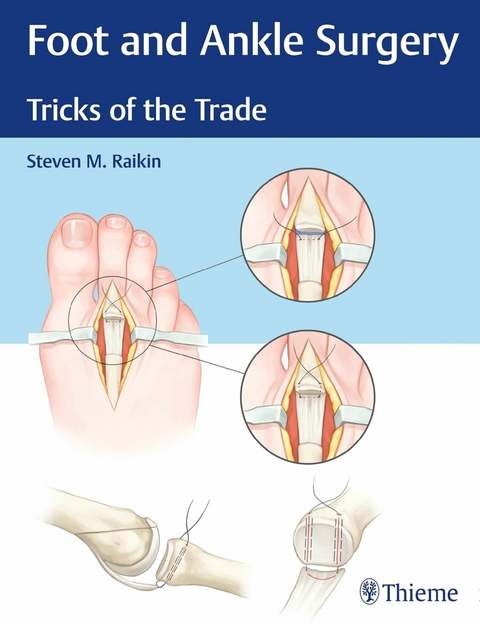 Foot and Ankle Surgery - Steven M. Raikin