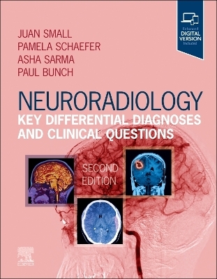 Neuroradiology: Key Differential Diagnoses and Clinical Questions - 