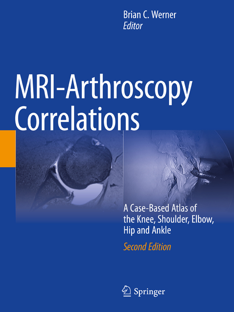 MRI-Arthroscopy Correlations - 