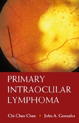 Primary Intraocular Lymphoma - Chi-Chao Chan, John A Gonzales