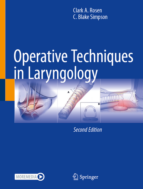 Operative Techniques in Laryngology - Clark A. Rosen, C. Blake Simpson