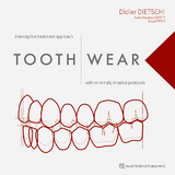 Tooth Wear - Didier Dietschi, Carlo Massimo Saratti, Serge Erpen