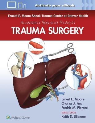 Ernest E. Moore Shock Trauma Center at Denver Health Illustrated Tips and Tricks in Trauma Surgery - 