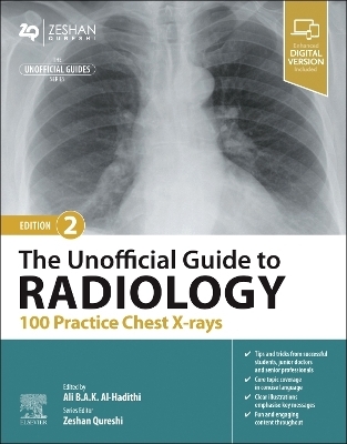 The Unofficial Guide to Radiology: 100 Practice Chest X-rays - 