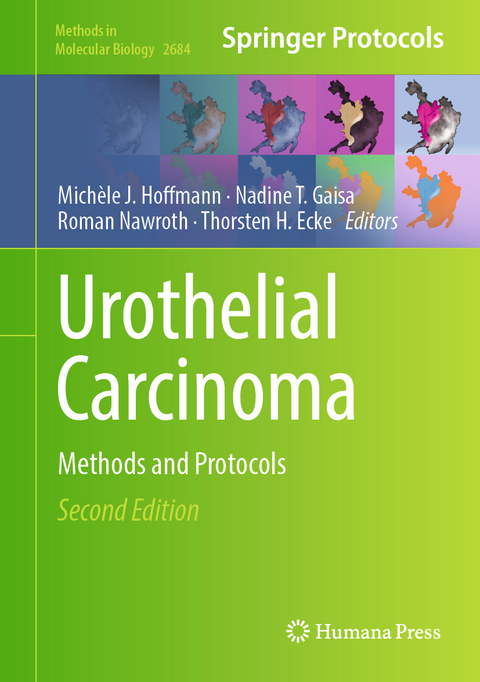 Urothelial Carcinoma - 