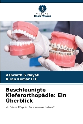 Beschleunigte Kieferorthopädie - Ashwath S Nayak, Kiran Kumar H C