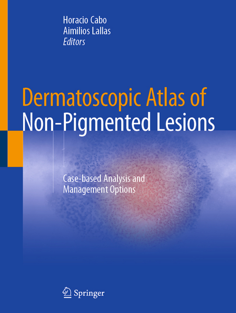 Dermatoscopic Atlas of Non-Pigmented Lesions - 
