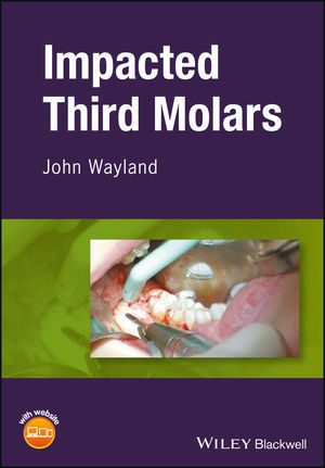 Impacted Third Molars - John Wayland