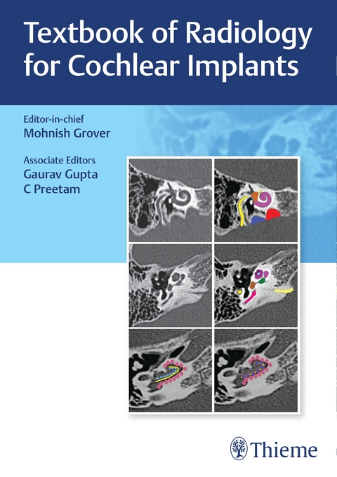 Textbook of Radiology for Cochlear Implants - 