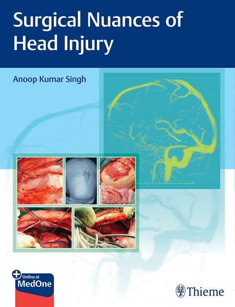 Surgical Nuances of Head Injury - 