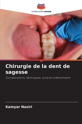 Chirurgie de la dent de sagesse - Kamyar Nasiri