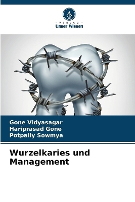 Wurzelkaries und Management - Gone Vidyasagar, Hariprasad Gone, Potpally Sowmya