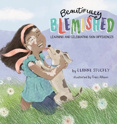 Beautifully Blemished - Leanne Stuckey