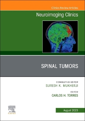 Spinal Tumors, An Issue of Neuroimaging Clinics of North America - 