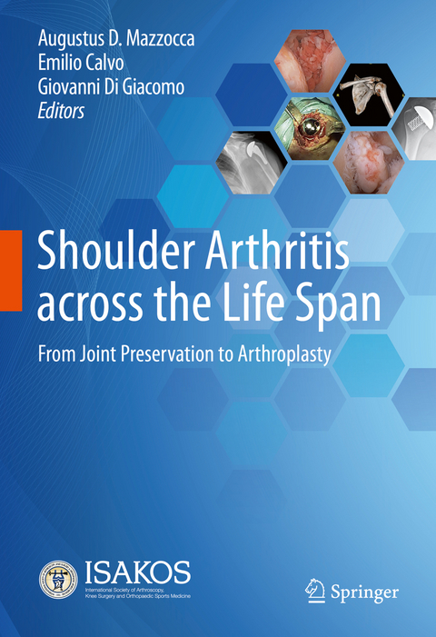 Shoulder Arthritis across the Life Span - 