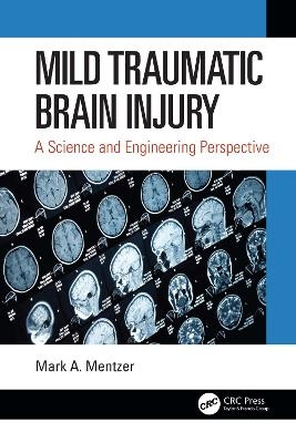 Mild Traumatic Brain Injury - Mark A. Mentzer