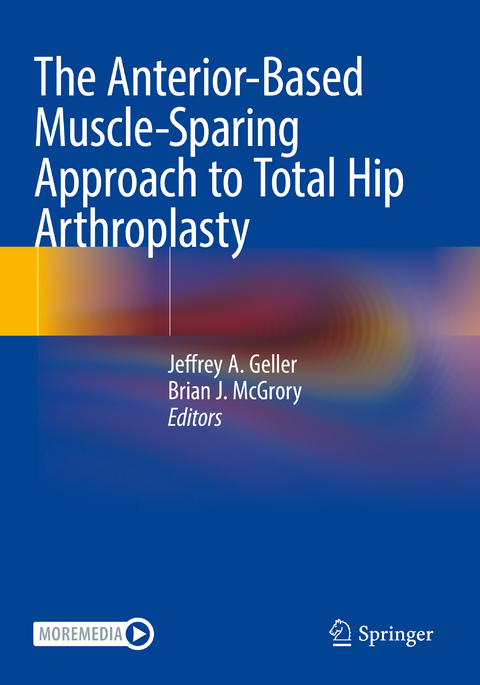 The Anterior-Based Muscle-Sparing Approach to Total Hip Arthroplasty - 